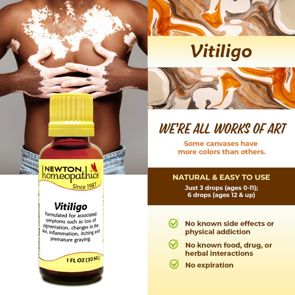 Newton Labs Vitiligo 1oz Liquid Product Information.jpg
